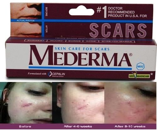 Mederma Skin Care Gel 10gm (Pack of 3)