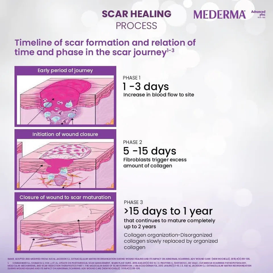 Mederma Advance Scar Gel 10gm (Pack of 3)