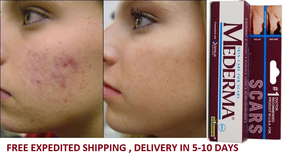 Mederma Skin Care Gel 10gm (Pack of 3)